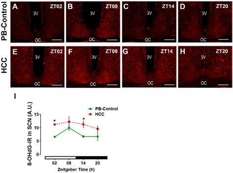 Hepatocellular Carcinoma in Mice Affects Neuronal Activity and Glia ...