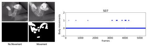 Non-Contact Respiration Monitoring and Body Movements Detection for ...