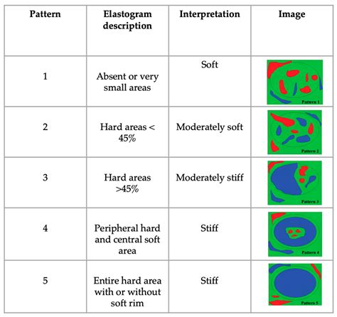 Ultrasonography and Sonoelastography Characteristics of Benign vs ...