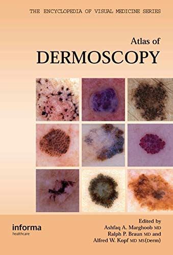 Buy An Atlas of Dermoscopy (Encyclopedia of Visual Medicine Series ...