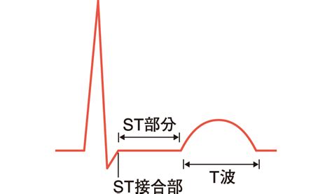 正常心電図｜心電図とはなんだろう（4） | 看護roo![カンゴルー]