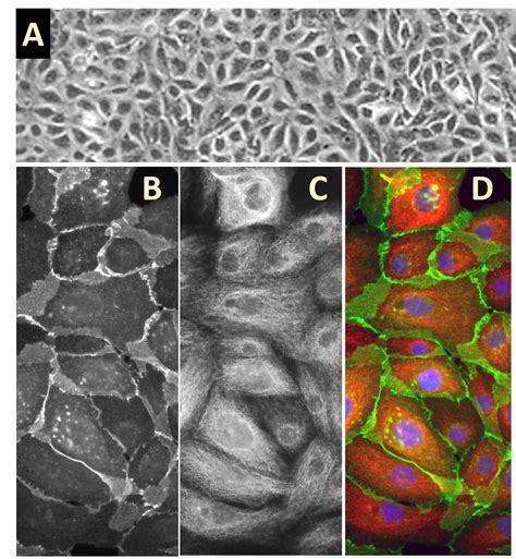 HMEpC | Primary Human Mammary Epithelial Cells | Life Technologies ...
