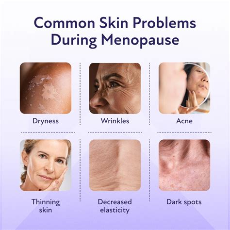 Menopause & Dry Skin: Symptoms, Causes & Treatment