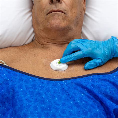 Dr. Kelly McFee, DNP, FNP-C, CWS, CWCN-AP, NE-BC, FACCWS on LinkedIn: Wearable sensor for HAPI ...