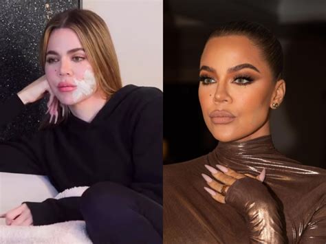 Khloe Kardashian Disclose her "stitched-up" Melanoma Face Surgery !!!! - All the updates of show ...
