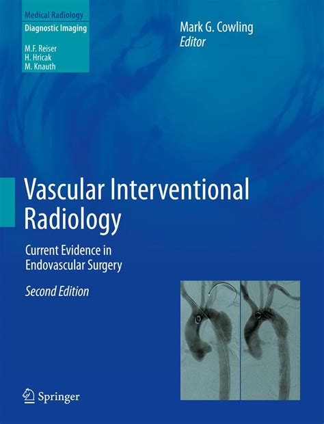 Buy Vascular Interventional Radiology: Current Evidence in Endovascular ...