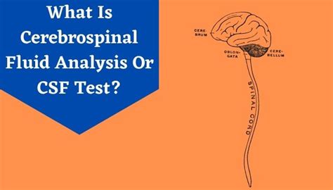 Cerebrospinal Fluid Analysis Test: Overview, Purpose, & Procedure | Livlong