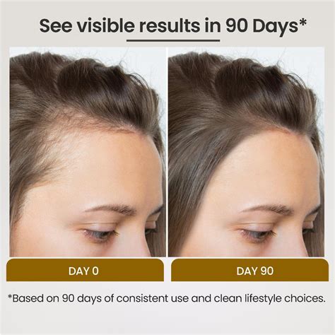 PHGLO Anti Dandruff Anti Hairfall Hair Growth Serum – Lio Cosmeds