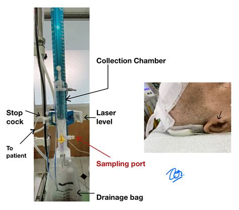 การดูแล ventriculostomy (EVD) เบื้องต้นสำหรับ Non-neurosurgeon: Practical Points – NIT Neurosurgery