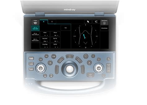 MX7 - General Imaging Ultrasound Systems - Mindray India