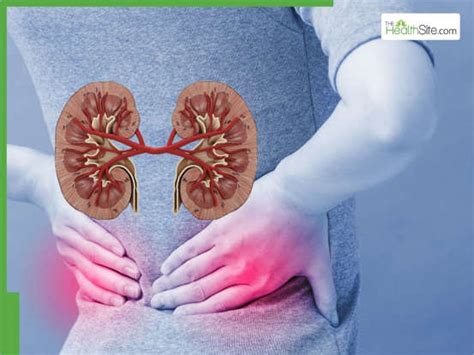 5 Unusual Types of Pain That Could Indicate Severe Kidney Damage