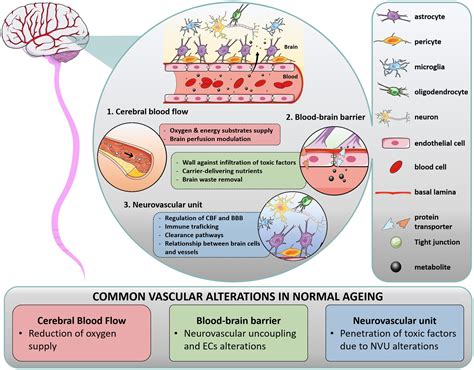 Vascular Dementia