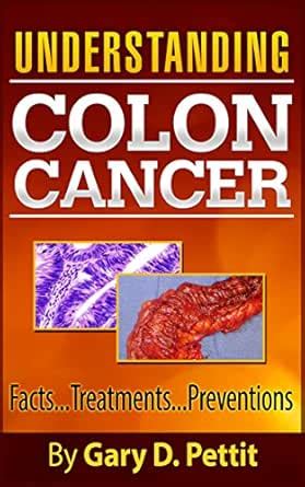 Colon Cancer - A Cancer Prevention and Cancer Cure Guide to ...