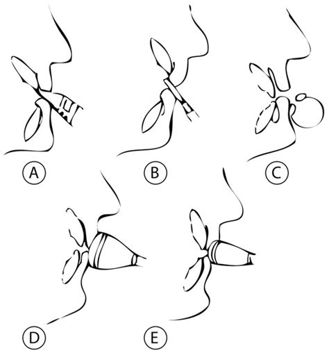 The Influence of Wind Musical Instruments on the Orofacial System