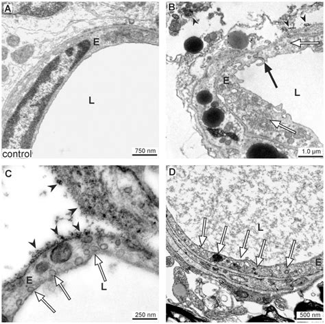 Image result for Contralateral Hemisphere