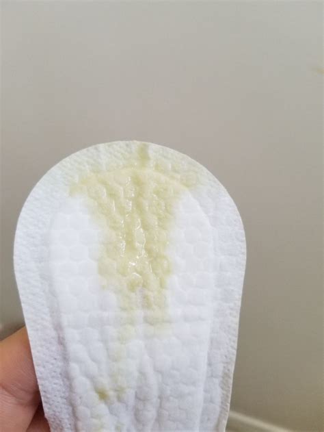 Yellow Green Discharge Female