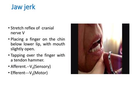 Cranial Nerves 5,7,8.ppt