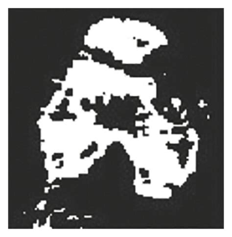 Image result for Image segmentation Methods