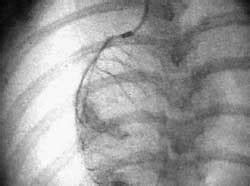 Image result for Fluoroscopy Magnification