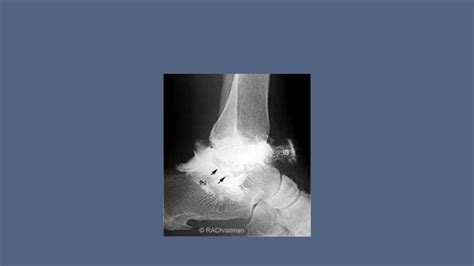 Image result for Arthogram Explained