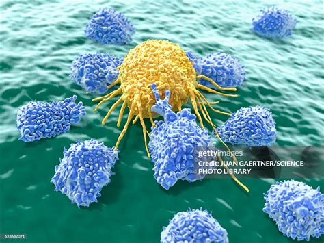Image result for Lymphocytes Cancer