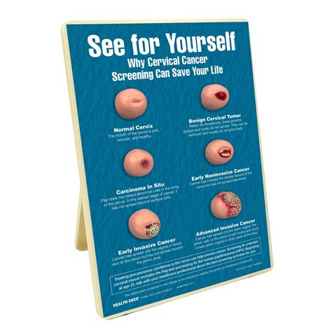 Pap Tests Easel Display For Health Education | Health Edco