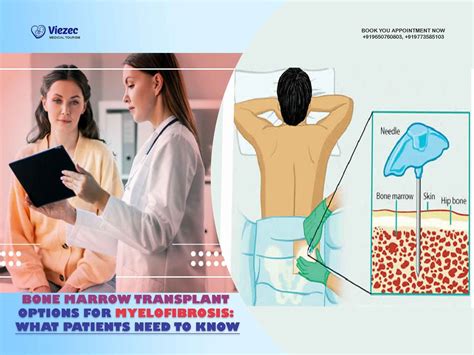 Bone Marrow Transplant Options For Myelofibrosis: Need To Know