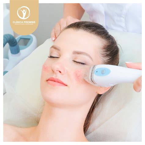 Tratamiento láser IPL para rosácea - Nueva Clínica Premins