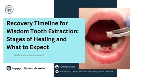 Image result for Tooth Extraction Timeline