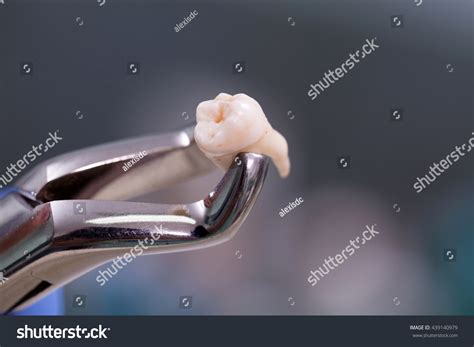 Image result for Tooth Extraction Surgery