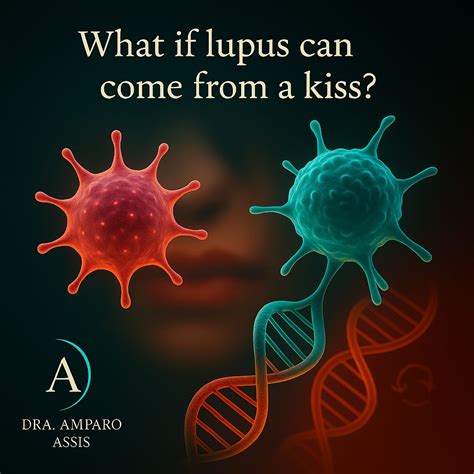 How a virus can trigger lupus: a new study on Epstein-Barr virus and ...