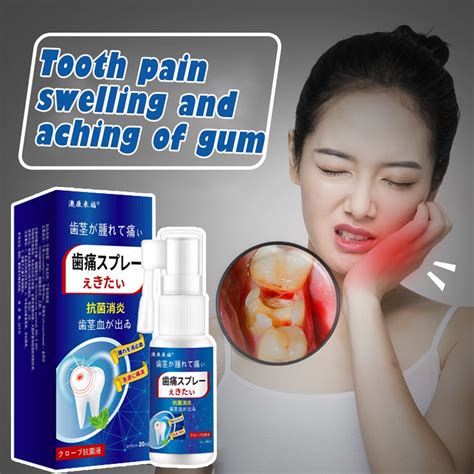 Toothache Treatment Spray Toothache Pain Reliever For Gum Inflammation Swelling Teeth Care Spray ...