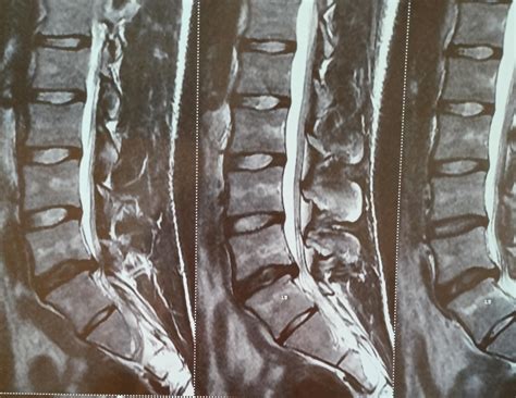 How bad is this? Has any of my friends here faced it before? Any help ...