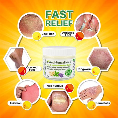 Antifungal Cream – Toenail Fungus Treatment Jock Itch Athletes Foot Ringworm Back Acne & Eczema ...