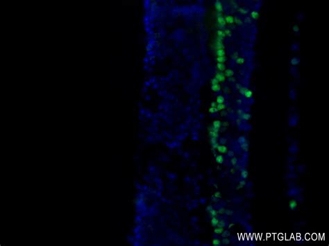PRDM8 antibody (84716-2-RR) | Proteintech
