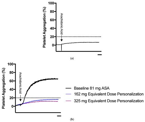 Personalization of Aspirin Therapy Ex Vivo in Patients with ...
