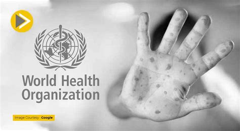 Monkeypox को लेकर WHO घोषित कर सकता है हेल्थ इमरजेंसी