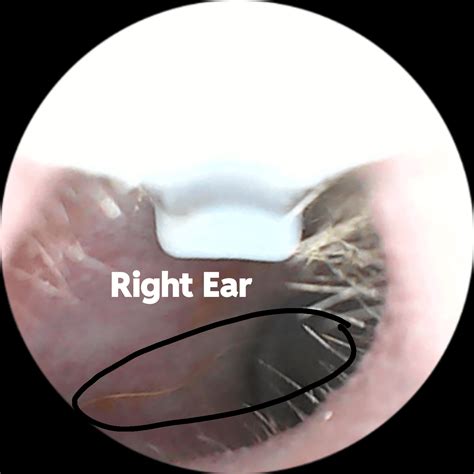 Thin hair in ear canals? : r/earwax