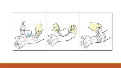 Image result for First Aid Knowledge