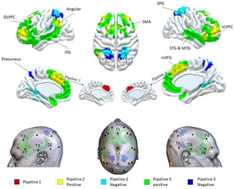 Potential Targets for Noninvasive Brain Stimulation on ...