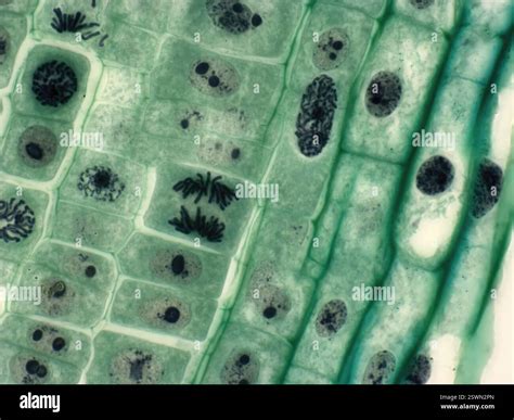 Plant cell mitosis. Light micrograph of root tip cells from an onion ...