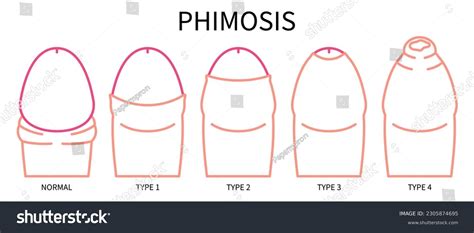 Image result for Simbol Lab API