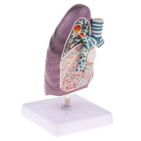 ⚡️Buy Maxbell Maxbell 2:3 Human Diseased Lung Structure Respiratory ...