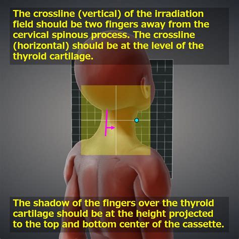 Image result for Contralateral View