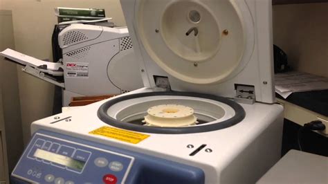 Image result for Fetalscreen II