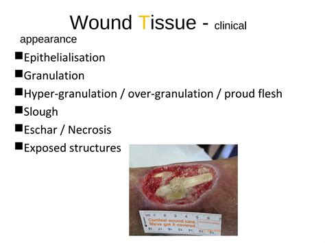 Wound assessment and products | PPT