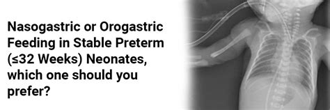 Nasogastric or Orogastric Feeding in Stable Preterm (≤32 Weeks ...
