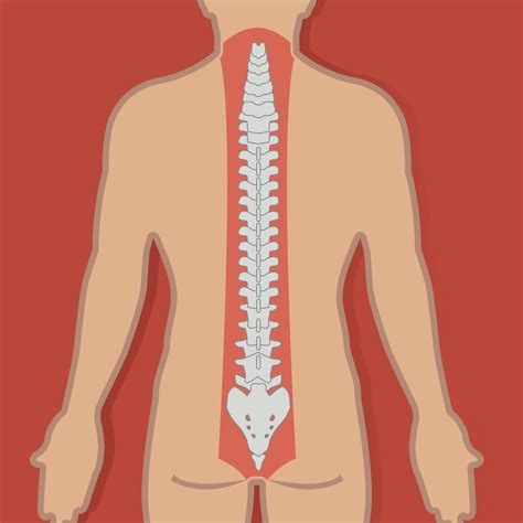 Types of Spinal Cord Injuries Chicago - Schwaner Injury Law