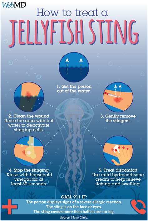 How To Treat Rash After Jellyfish Sting at Emily Jenkins blog
