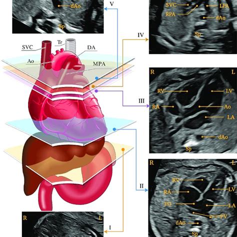 Image result for Fetal Bleed Screen Kit Parallel Testing
